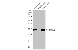 Anti-TRIM72 antibody [HL1853] used in Western Blot (WB). GTX637578