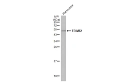 Anti-TRIM72 antibody [HL1855] used in Western Blot (WB). GTX637580