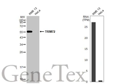 Anti-TRIM72 antibody [HL1855] used in Western Blot (WB). GTX637580