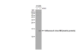 Anti-Influenza A virus M2 (matrix protein) antibody [HL1856] used in Western Blot (WB). GTX637581
