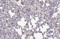 Anti-IL18 antibody [HL1859] used in IHC (Paraffin sections) (IHC-P). GTX637584