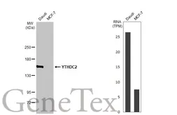 Anti-YTHDC2 antibody [HL1861] used in Western Blot (WB). GTX637586