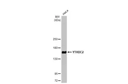 Anti-YTHDC2 antibody [HL1861] used in Western Blot (WB). GTX637586