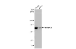 Anti-YTHDC2 antibody [HL1862] used in Western Blot (WB). GTX637587