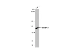 Anti-YTHDC2 antibody [HL1862] used in Western Blot (WB). GTX637587