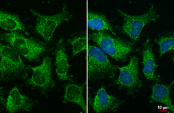 Anti-YTHDC2 antibody [HL1862] used in Immunocytochemistry/ Immunofluorescence (ICC/IF). GTX637587