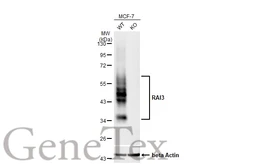 Anti-RAI3 antibody [HL1864] used in Western Blot (WB). GTX637589