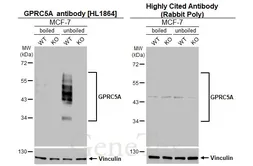 Anti-GPRC5A antibody [HL1864] used in Western Blot (WB). GTX637589