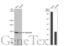 Anti-Vinculin antibody [HL1873] used in Western Blot (WB). GTX637622