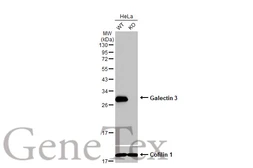 Anti-Galectin 3 antibody [HL1878] used in Western Blot (WB). GTX637627