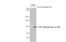 Anti-IRE1 alpha (phospho Ser724) antibody [HL1885] used in Western Blot (WB). GTX637634