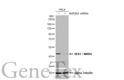 Anti-SEK1 / MKK4 antibody [HL1888] used in Western Blot (WB). GTX637637