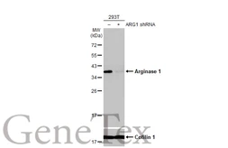 Anti-Arginase 1 antibody [HL1891] used in Western Blot (WB). GTX637640
