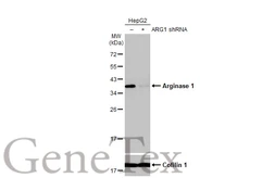 Anti-Arginase 1 antibody [HL1891] used in Western Blot (WB). GTX637640