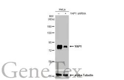 Anti-YAP1 antibody [HL1894] used in Western Blot (WB). GTX637643