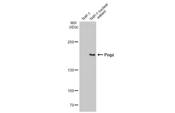 Anti-Pogz antibody [HL1898] used in Western Blot (WB). GTX637647