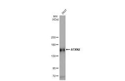 Anti-ATXN2 antibody [HL1902] used in Western Blot (WB). GTX637651