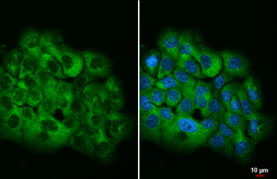 Anti-ATXN2 antibody [HL1902] used in Immunocytochemistry/ Immunofluorescence (ICC/IF). GTX637651