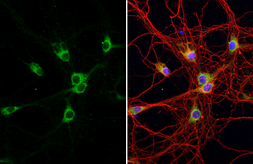 Anti-ATXN2 antibody [HL1902] used in Immunocytochemistry/ Immunofluorescence (ICC/IF). GTX637651