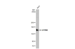 Anti-ATXN2 antibody [HL1903] used in Western Blot (WB). GTX637652