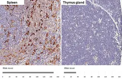 Anti-Ferritin Heavy Chain antibody [HL1905] used in IHC (Paraffin sections) (IHC-P). GTX637654