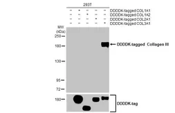 Anti-Collagen III antibody [HL1906] used in Western Blot (WB). GTX637655