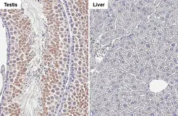 Anti-Collagen III antibody [HL1906] used in IHC (Paraffin sections) (IHC-P). GTX637655