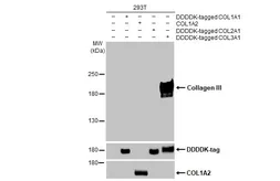 Anti-Collagen III antibody [HL1908] used in Western Blot (WB). GTX637657