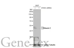 Anti-Ataxin 3 antibody [HL1909] used in Western Blot (WB). GTX637658