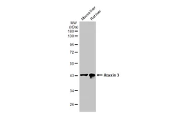 Anti-Ataxin 3 antibody [HL1909] used in Western Blot (WB). GTX637658