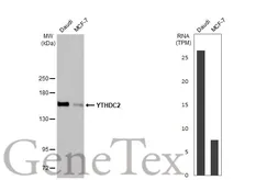 Anti-YTHDC2 antibody [HL1916] used in Western Blot (WB). GTX637665