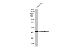 Anti-beta Actin antibody [HL1926] used in Western Blot (WB). GTX637675