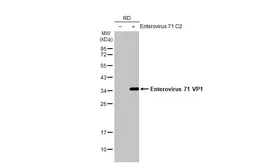 Anti-Enterovirus 71 VP1 antibody [HL1928] used in Western Blot (WB). GTX637687