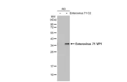 Anti-Enterovirus 71 VP1 antibody [HL1929] used in Western Blot (WB). GTX637688