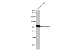 Anti-Gelsolin antibody [HL1931] used in Western Blot (WB). GTX637768