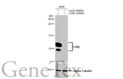 Anti-LY6E antibody [HL1933] used in Western Blot (WB). GTX637770