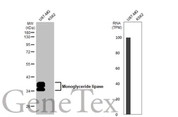 Anti-Monoglyceride lipase antibody [HL1937] used in Western Blot (WB). GTX637774