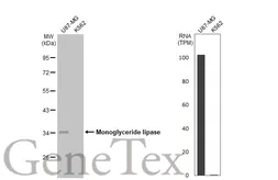 Anti-Monoglyceride lipase antibody [HL1938] used in Western Blot (WB). GTX637775
