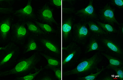 Anti-SUN1 antibody [HL1946] used in Immunocytochemistry/ Immunofluorescence (ICC/IF). GTX637783