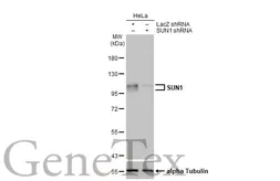 Anti-SUN1 antibody [HL1947] used in Western Blot (WB). GTX637784