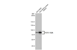 Anti-TCF3 / E2A antibody [HL1954] used in Western Blot (WB). GTX637791