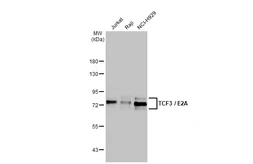 Anti-TCF3 / E2A antibody [HL1955] used in Western Blot (WB). GTX637792