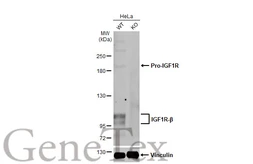Anti-IGF1R antibody [HL1957] used in Western Blot (WB). GTX637794