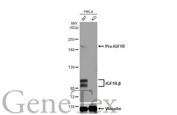 Anti-IGF1R antibody [HL1958] used in Western Blot (WB). GTX637795