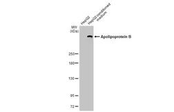 Anti-Apolipoprotein B antibody [HL1960] used in Western Blot (WB). GTX637797