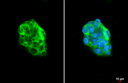 Anti-Apolipoprotein B antibody [HL1962] used in Immunocytochemistry/ Immunofluorescence (ICC/IF). GTX637799