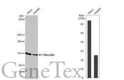 Anti-Vinculin antibody [HL1964] used in Western Blot (WB). GTX637857
