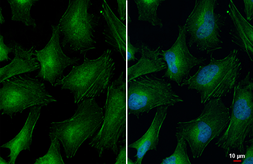 Anti-Vinculin antibody [HL1964] used in Immunocytochemistry/ Immunofluorescence (ICC/IF). GTX637857