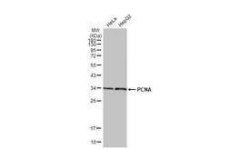 Anti-PCNA antibody [HL1965] used in Western Blot (WB). GTX637858