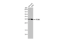 Anti-PCNA antibody [HL1965] used in Western Blot (WB). GTX637858